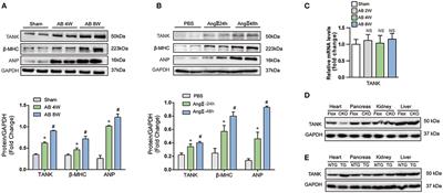 TANK Promotes Pressure Overload Induced Cardiac Hypertrophy via Activating AKT Signaling Pathway